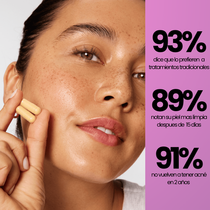 Velve DERMACORE - Suplemento Hormonal Para El Acné